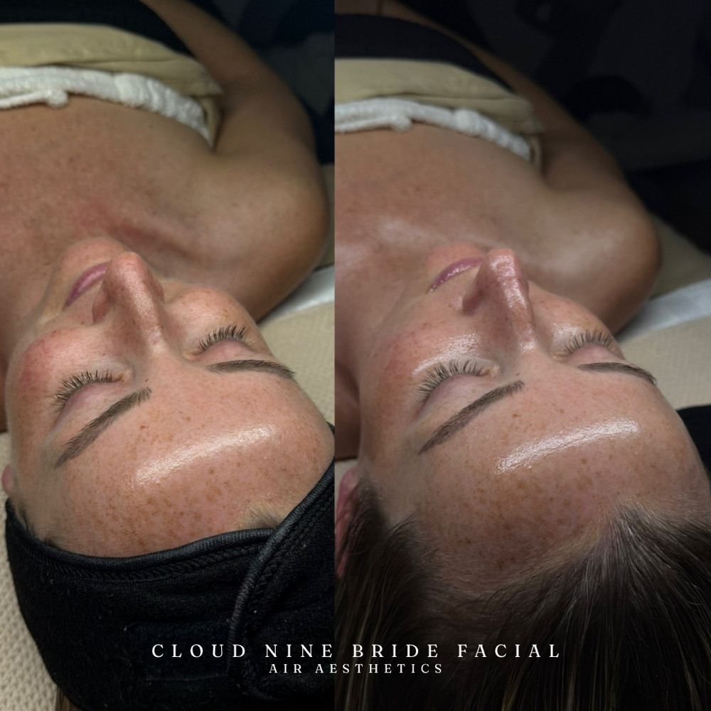 Cloud Nine Bride Facial