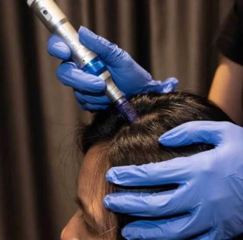 Booster Serum microneedling