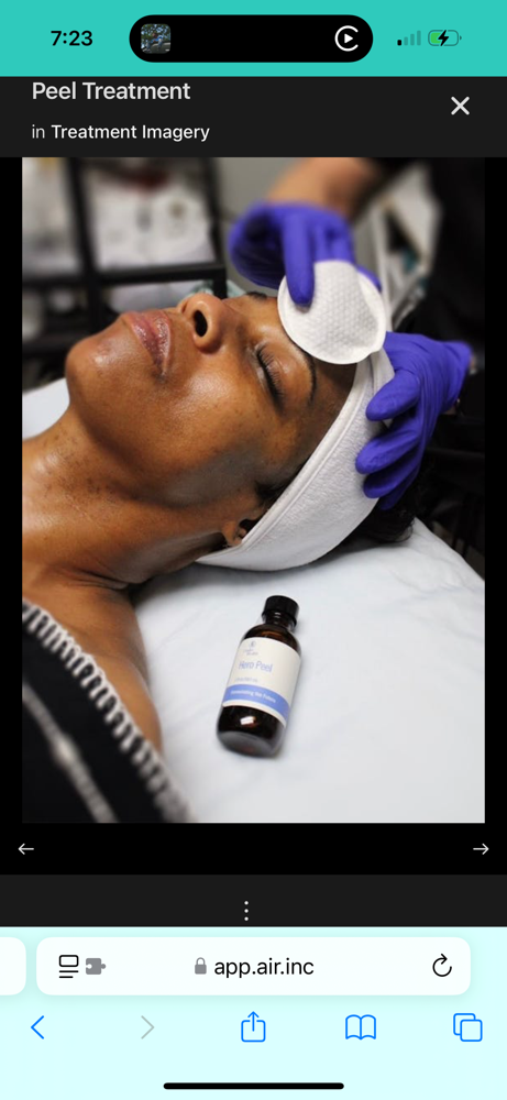 Linder Chemical Peel