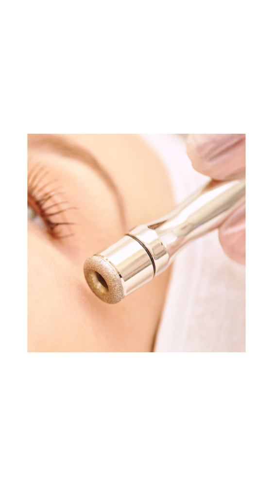 Microdermabrasion