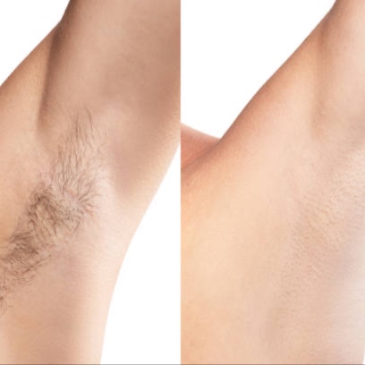Underarms at LuxBareBits in Wantagh, NY