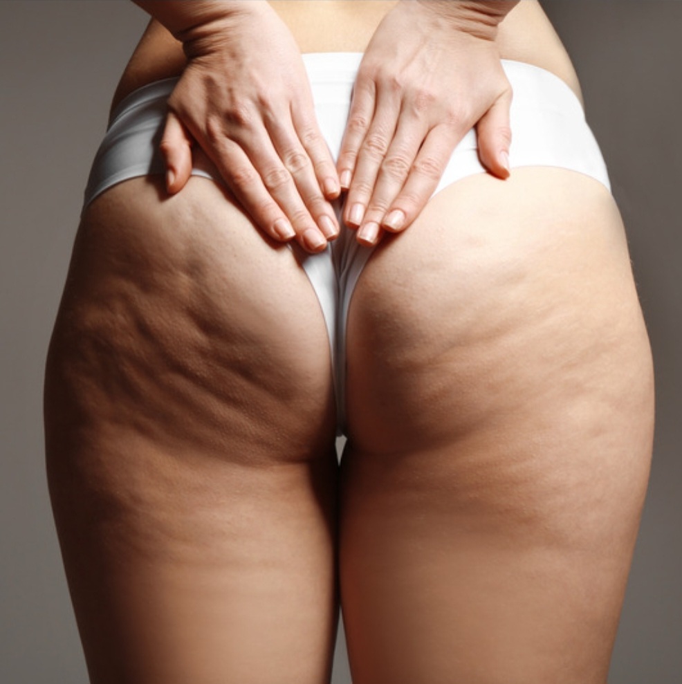 Full Butt