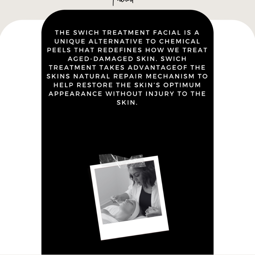 SWICH TREATMENT at Aesthetics By Abigail Hernandez in Mustang, OK