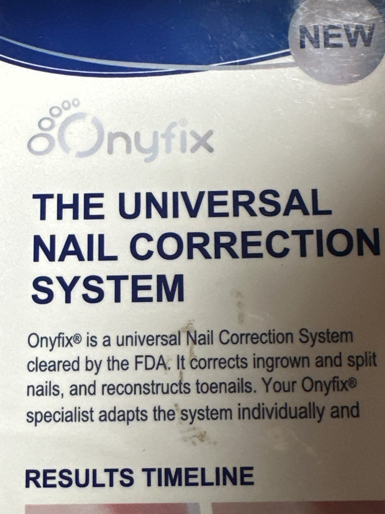 Onyfix Two Bands