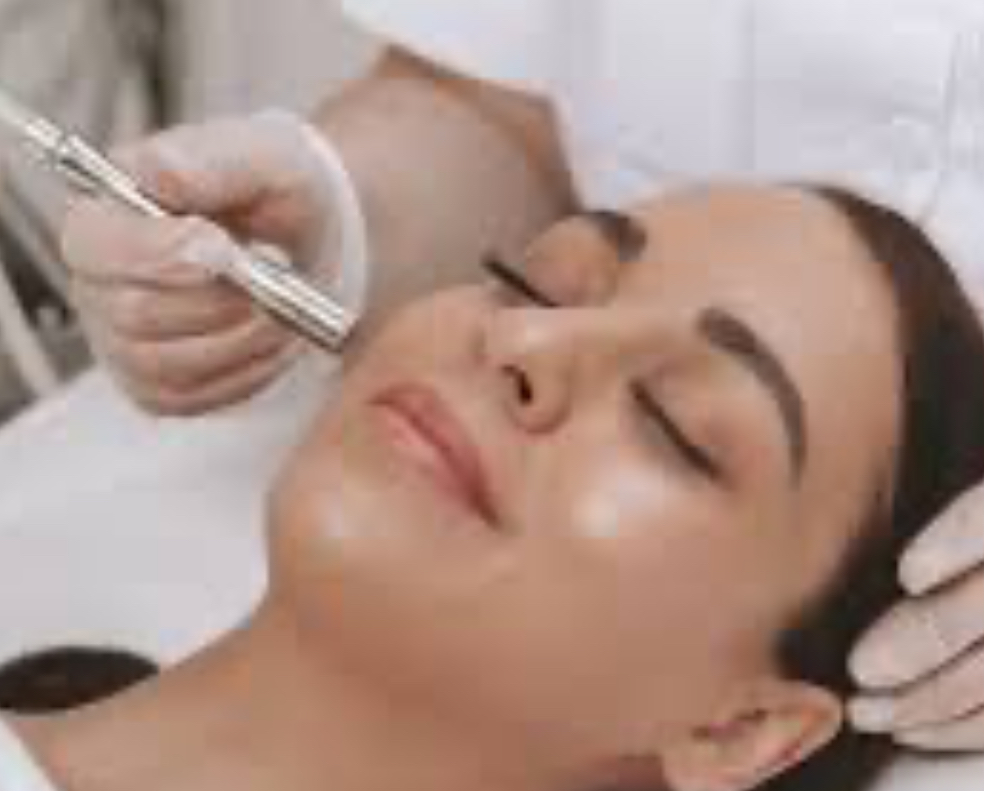 Microdermabrasion treatment