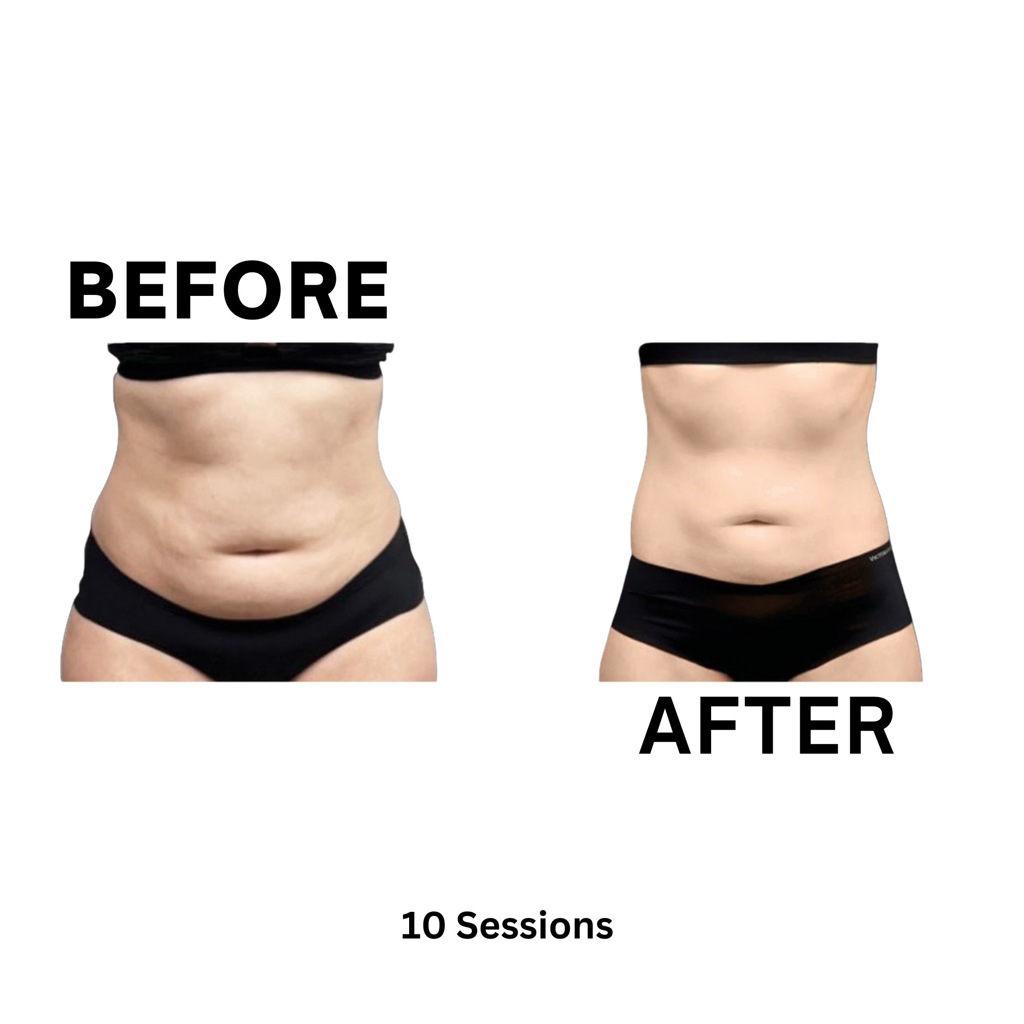 $179 Meltdown Package at Get Body Sculpted in Atlanta, GA