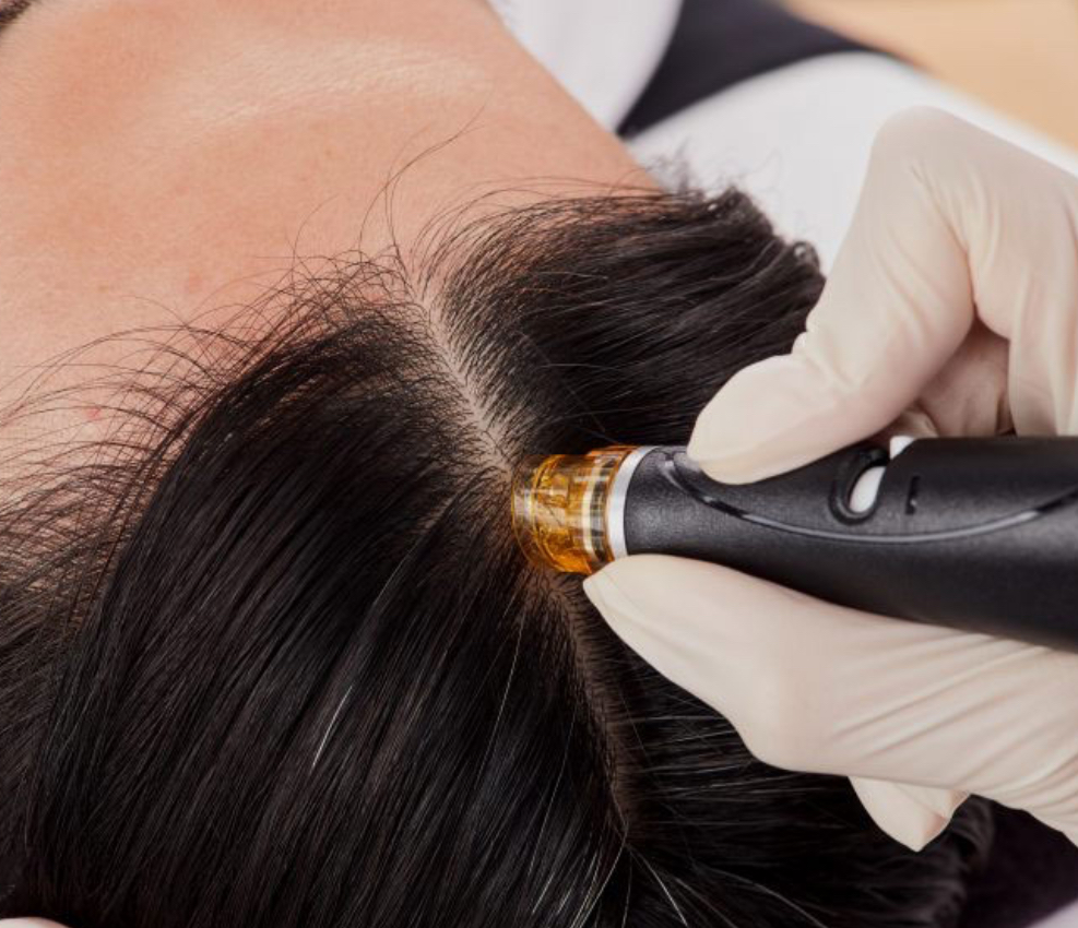 Keravive Scalp