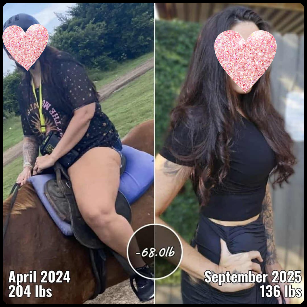 Weight-Loss Tirzepatide injections
