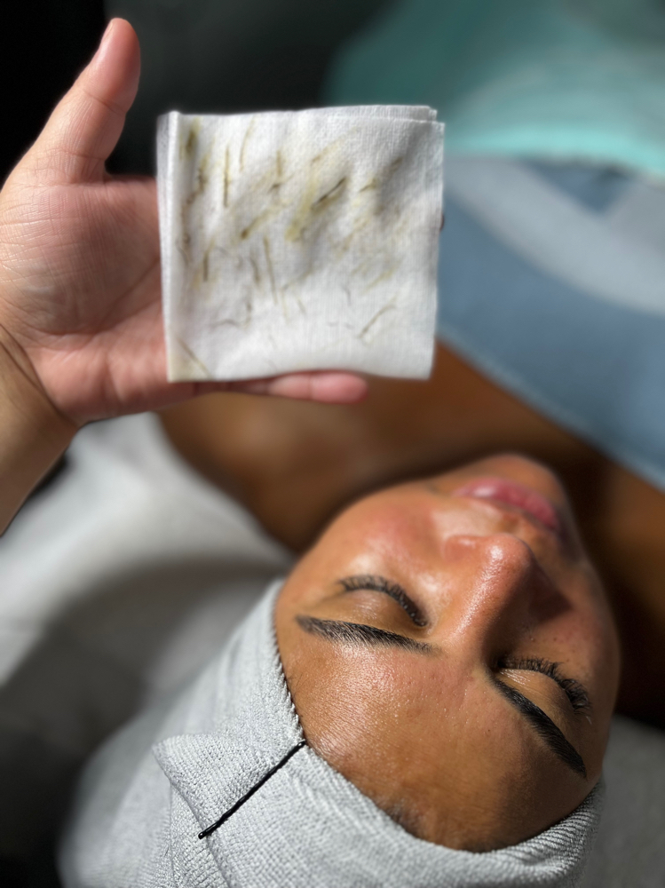 DERMAPLANE at Ethereal Skin x Jenn in Bloomfield, NJ
