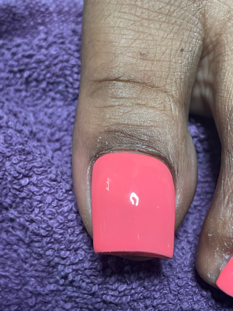 Foreign Big Toe Soak Off