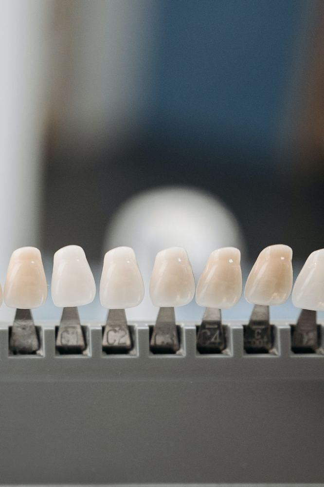 Teeth Whitening