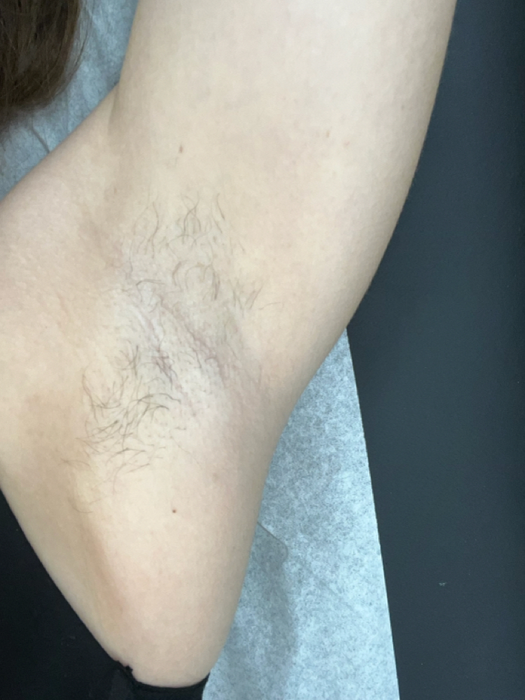 Brazilian Wax + Underarm Wax at Kimmchiliftz in New Ellenton, SC