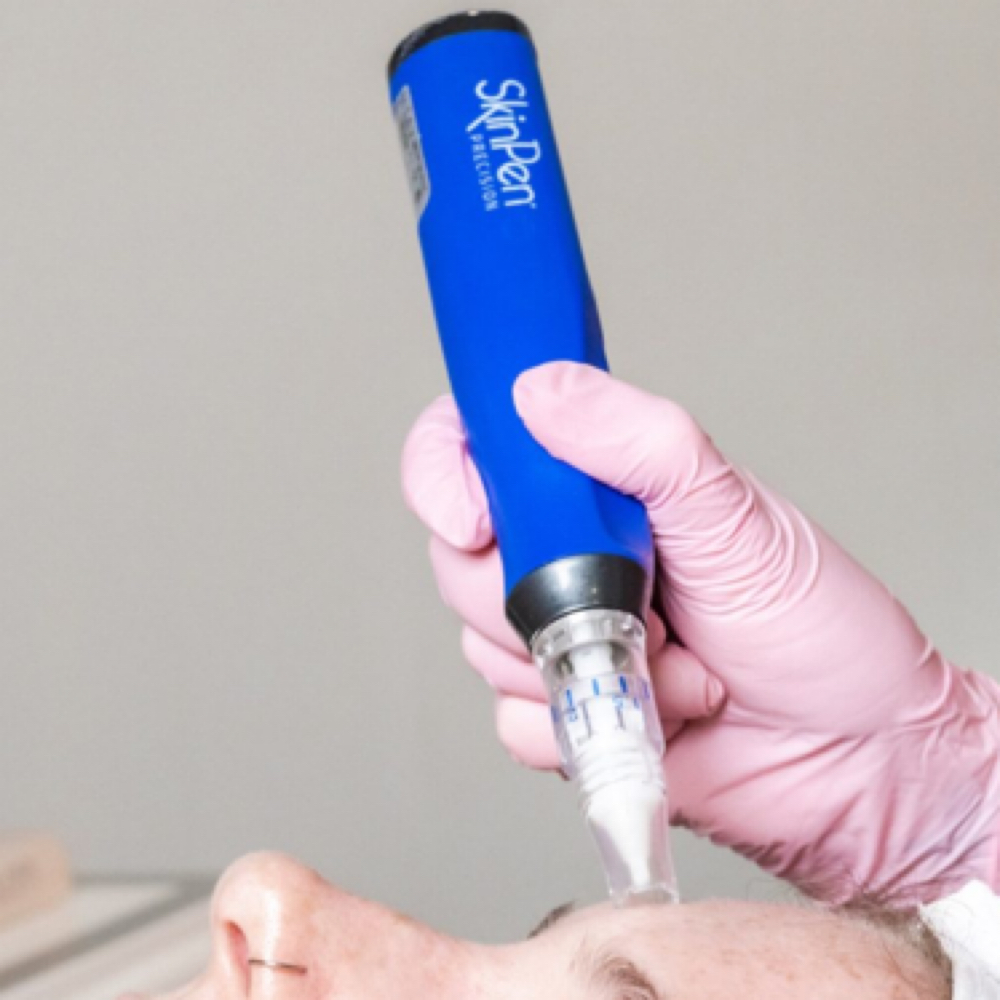 SkinPen Microneedling