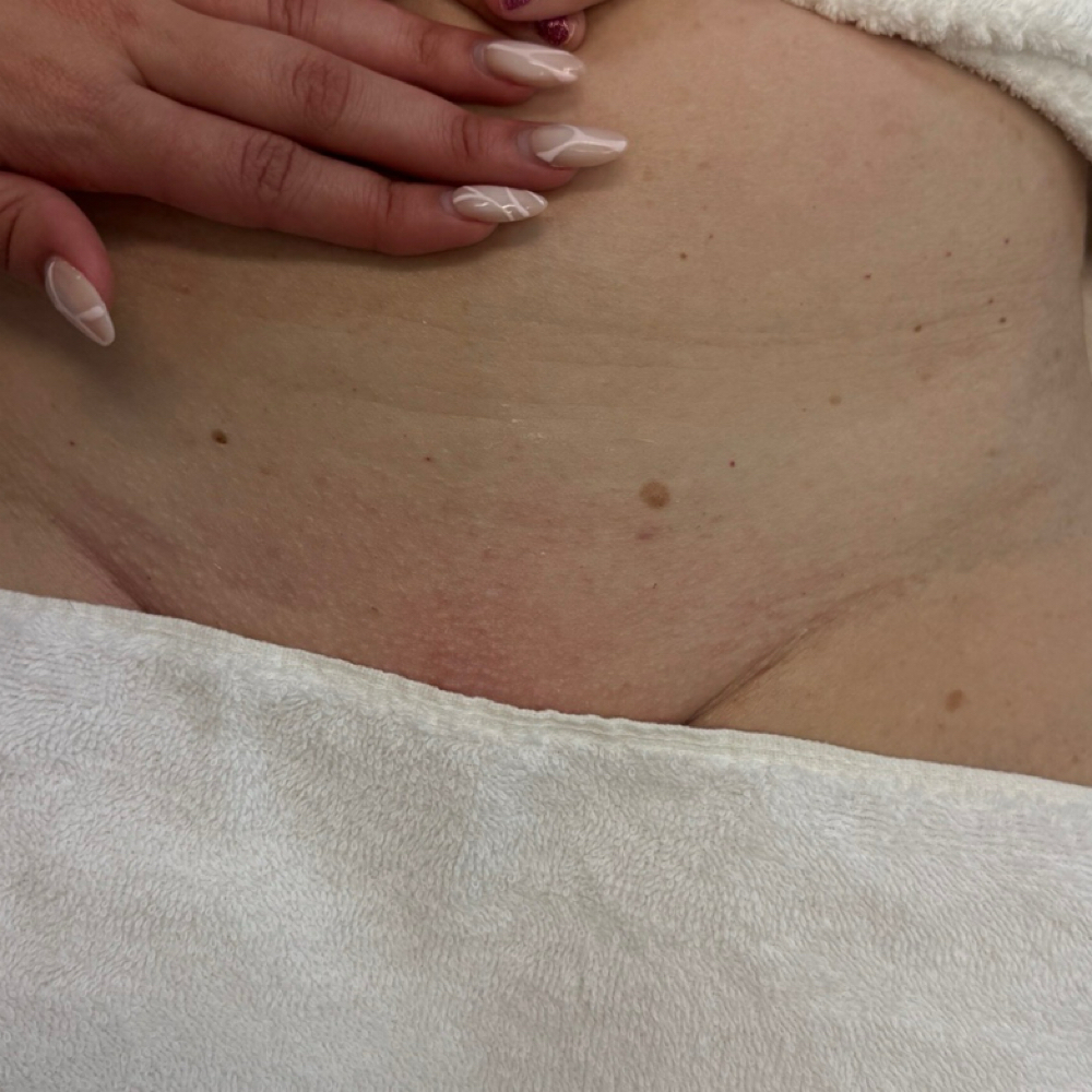 Brazilian Wax (Room #1) at Competitive Edge Massage and Wellness in Auburndale, FL