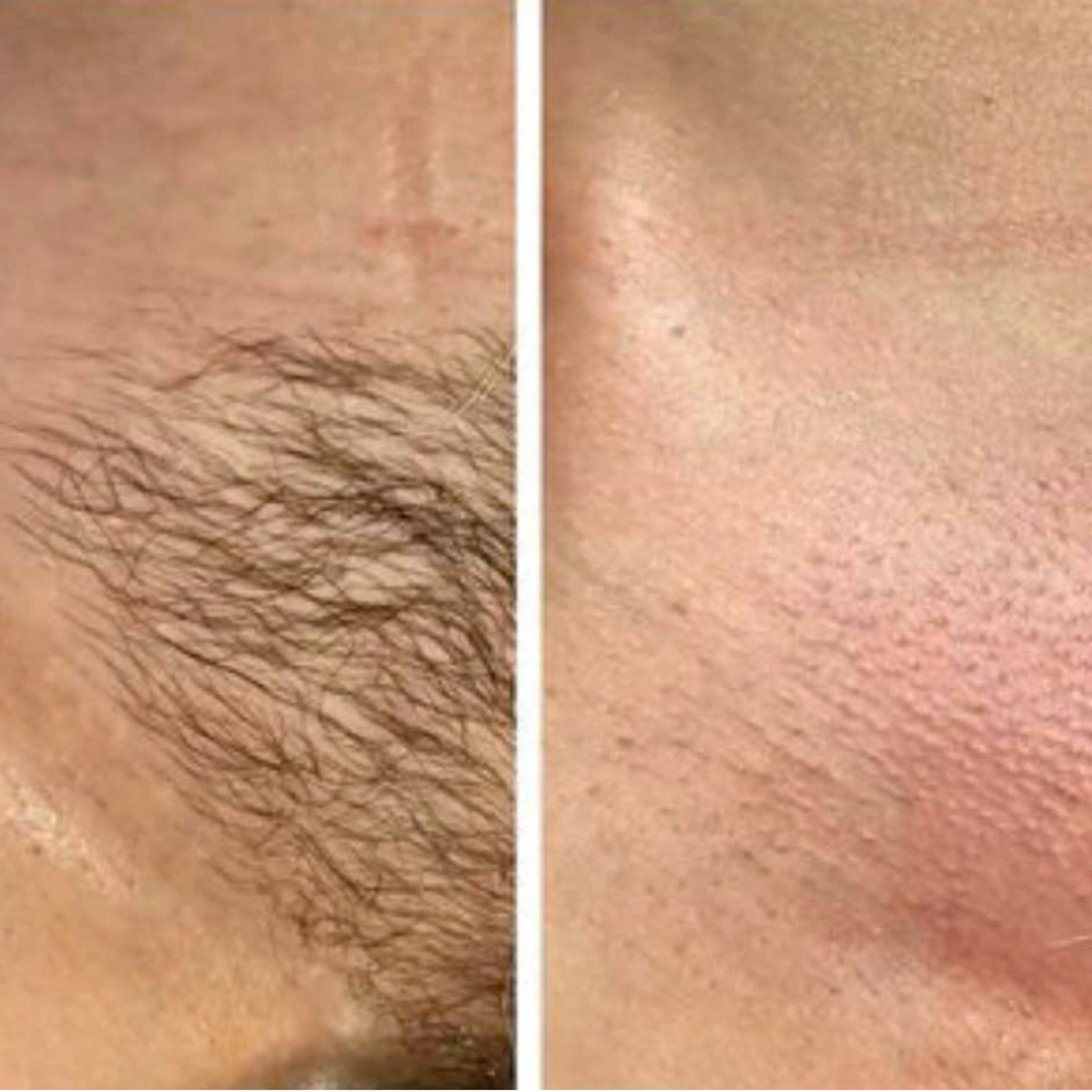 Bikini Full (V) at Belladz Wax Studio in Beltsville, MD