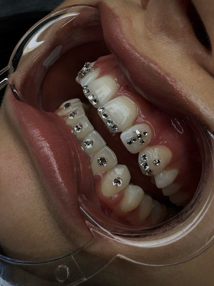 10 Tooth Gems
