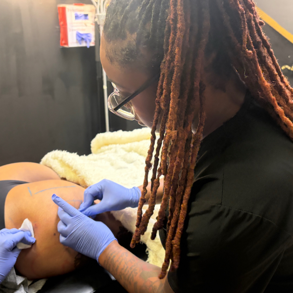 Bbl Class at Enhance Aesthetics Medspa in Arlington, TX