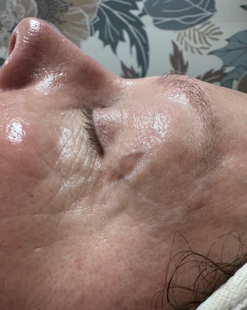 Spring Glow Facial