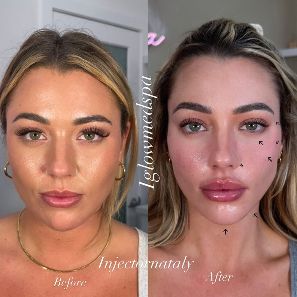 ⭐️ Level UP Facial Balance + TOX at Savage Artistry in melbourne, FL