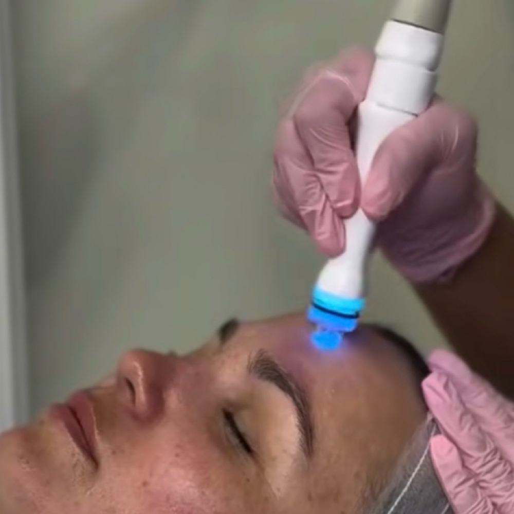 Hydro Facial at 227 Aesthetics in Sterling Heights, MI