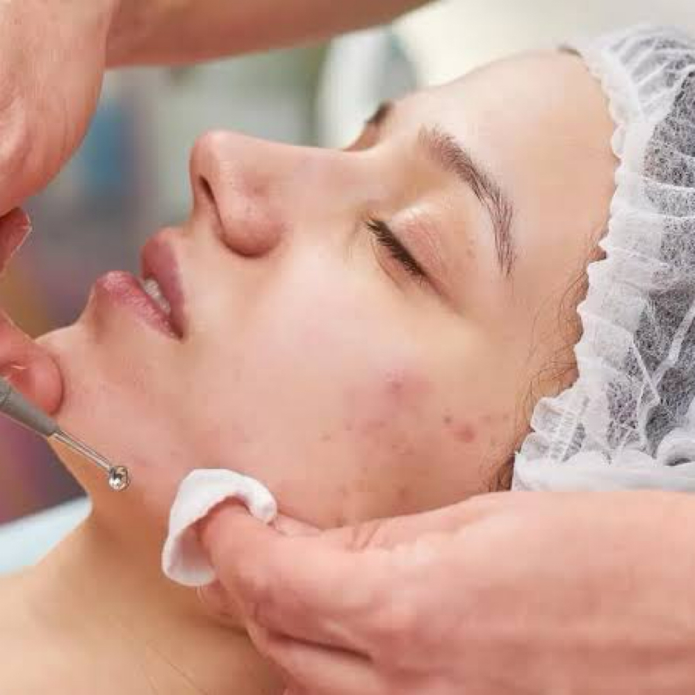 Basic Acne Clarifying Facial at ENDLESS BEAUTY AESTHETICS LLC in Grand praire, TX