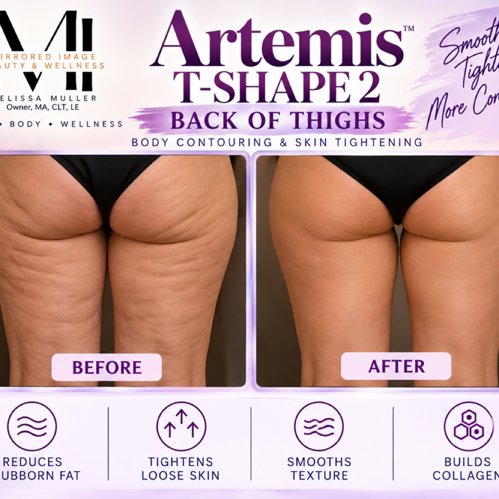 Artemis T- Shape 2 - Buttocks + Back of Thighs at Mirrored Image Beauty & Wellness in Oconomowoc, WI