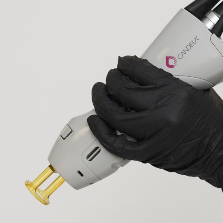 Lower Legs at Coco Aesthetics Medspa in Austin, TX