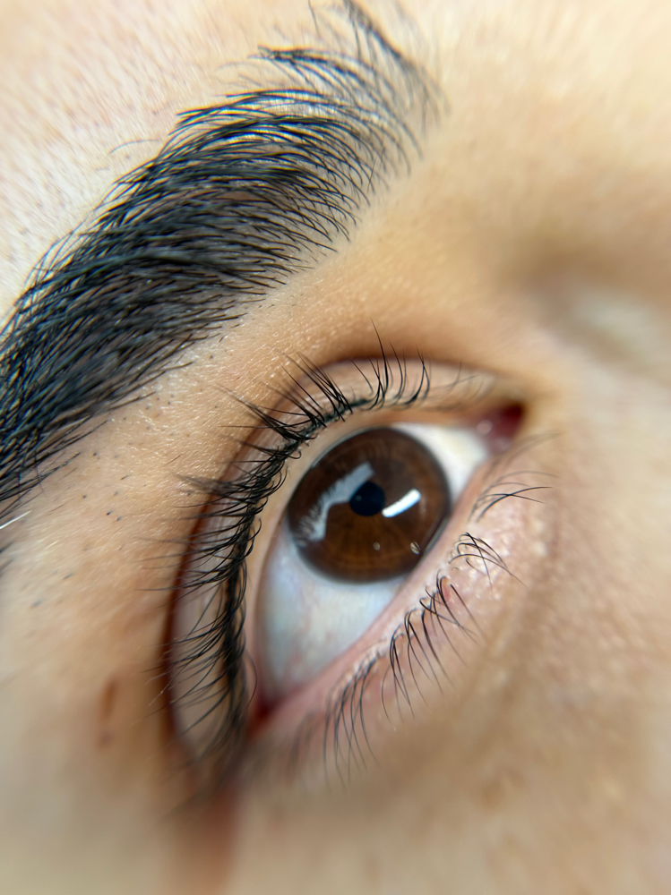 Lash Enhancement