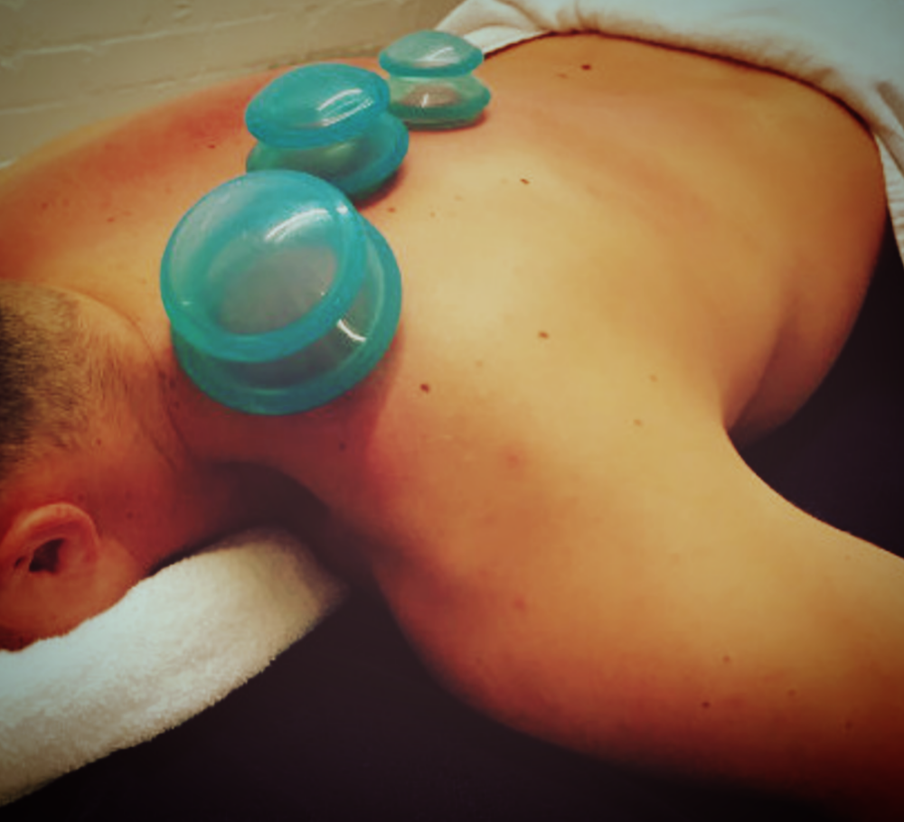 Cupping Therapy