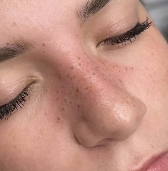 Faux Freckles