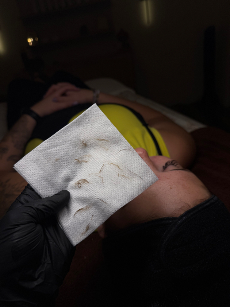 Dermaplane Treatment