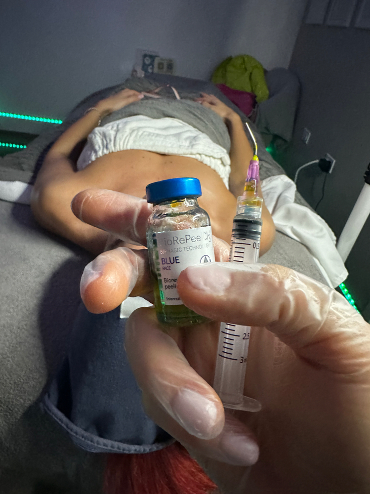 BioRePeel (6 Treatments)