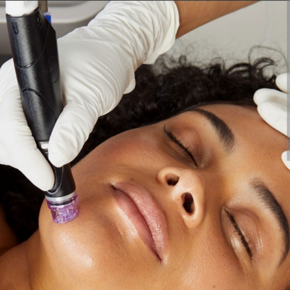 The Cityskin "Hydrofacial" at CITYSKIN in Southaven, MS