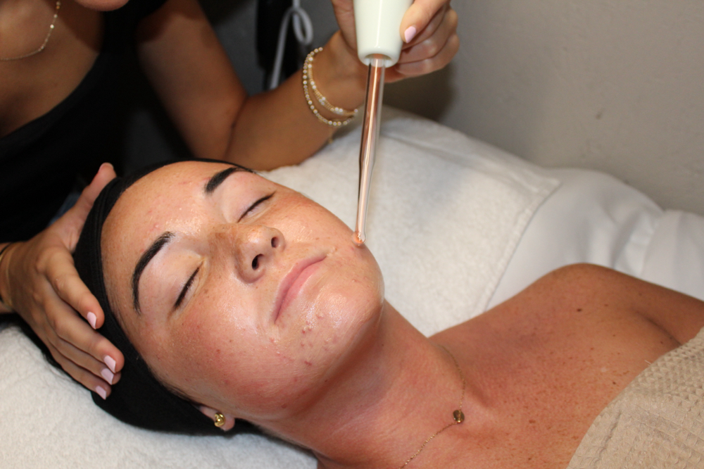 High Frequency at Stillwater Esthetics in Pell City, AL