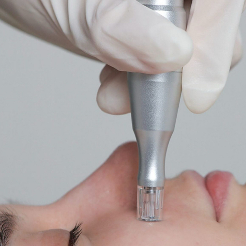 The Nano Infusion Facial at Skinbarre by Cheyanne in Columbus, OH