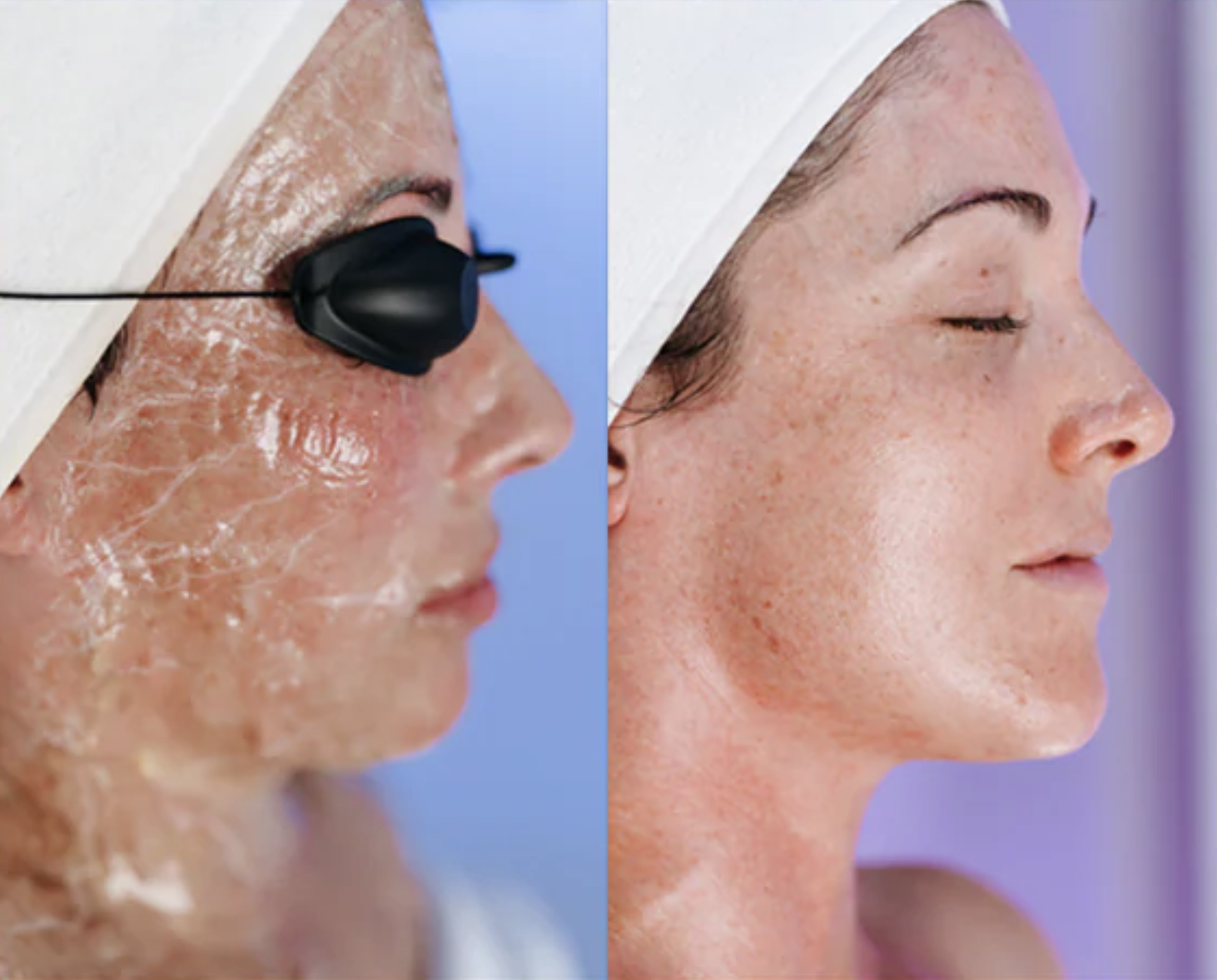 Zombie Facial - Firming Treatment