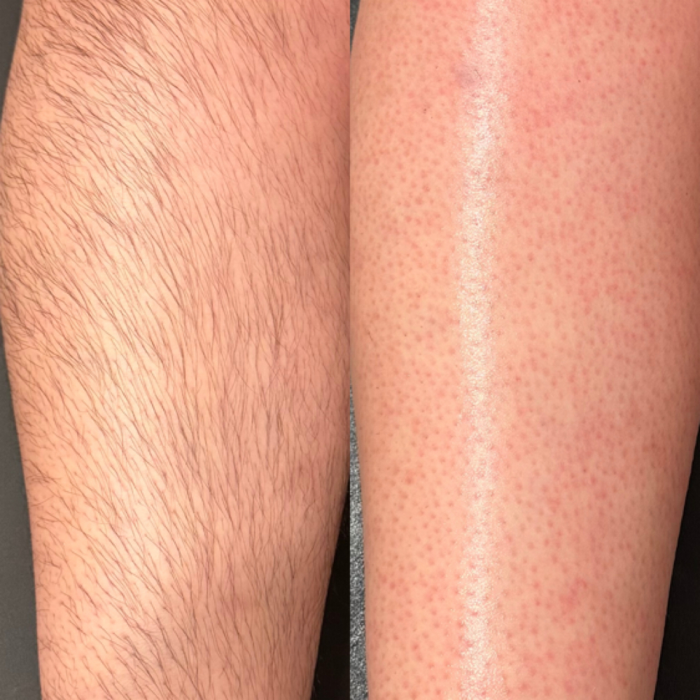 Half Leg Wax at Crystal Clear Skin by Madison in Sherman, TX