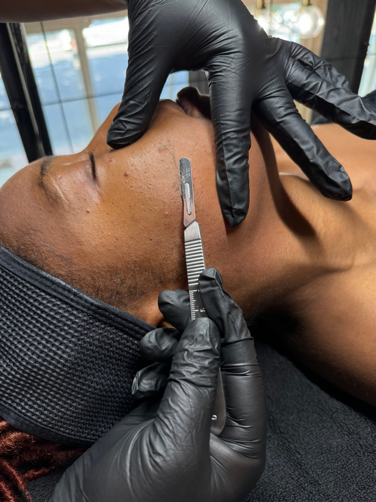 Dermaplane Facial