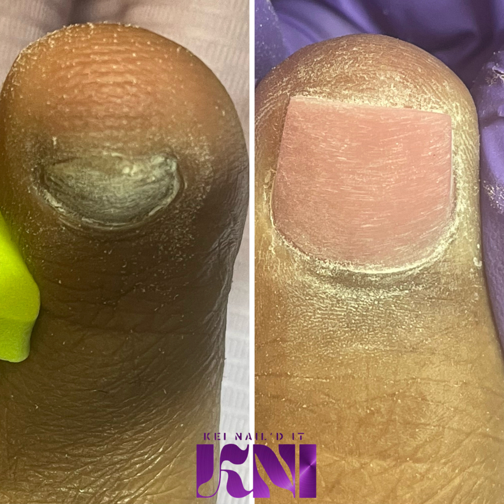 Toe Renovation “Kei, Fix My Toe” at Kei Nail’d It in Detroit, MI