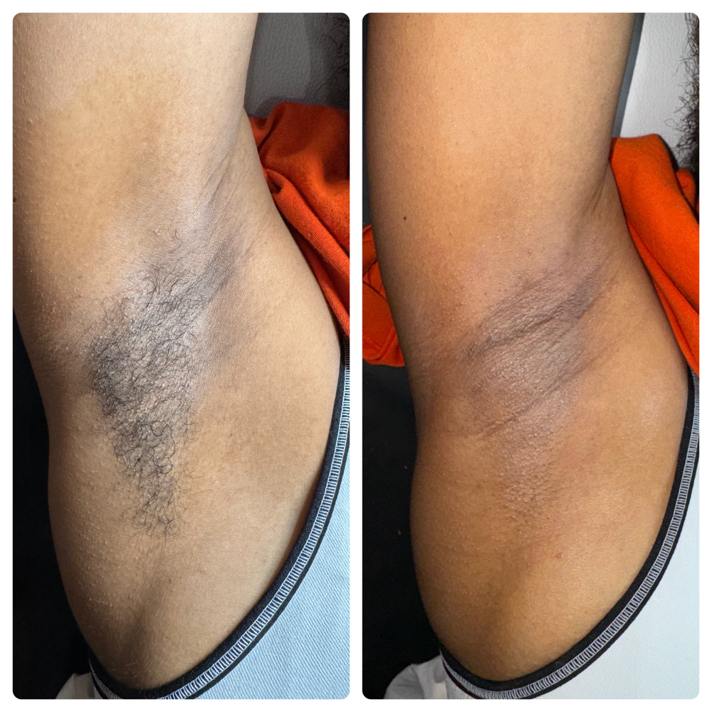 Underarm Wax