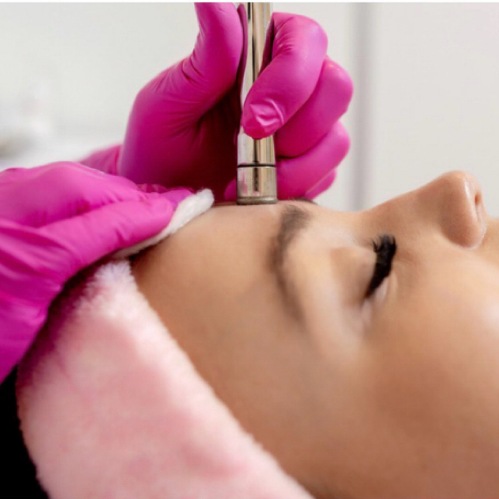 Diamond Microdermabrasion Facial at Divine Skin Studio in Houston, TX