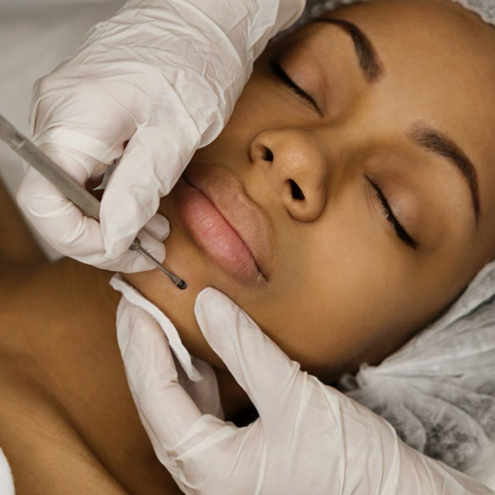 Extractions (individual service) at Mimi Bombshell Beauty Co in Walkersville, MD