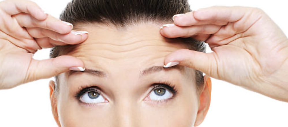Forehead Lines