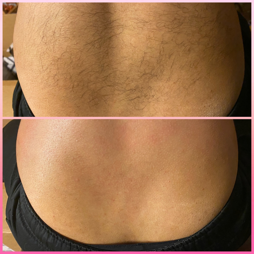 Lower Back Wax
