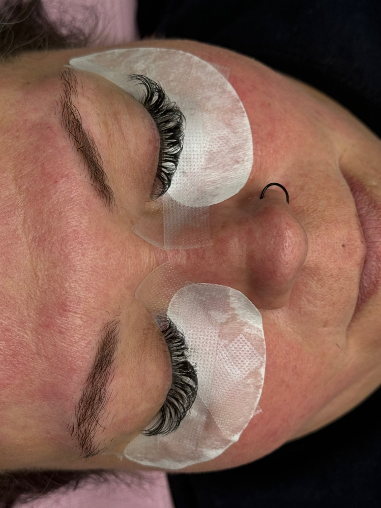 Hybrid Lash Set
