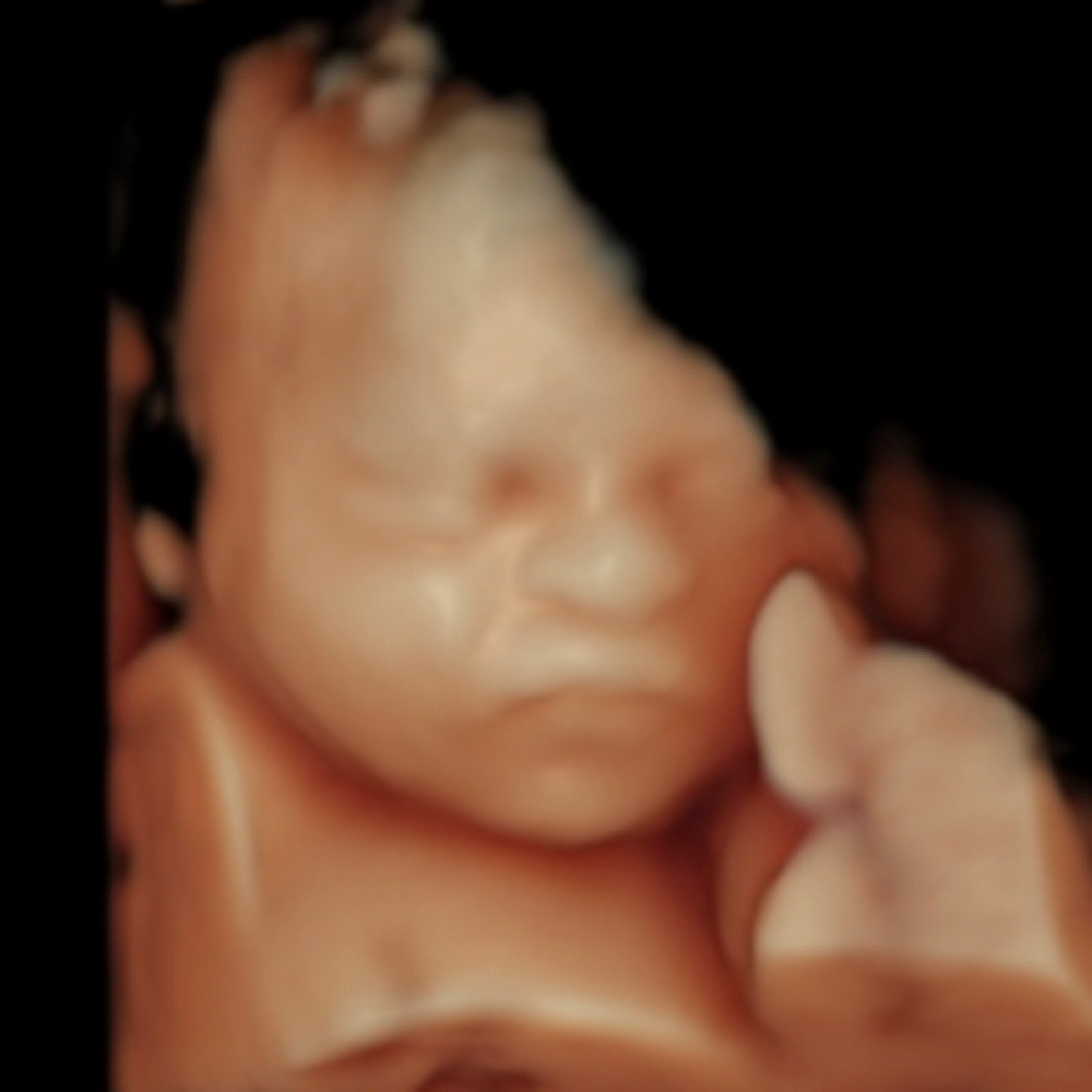 HD Live Package at Hello Baby 3d 4d Ultrasound Studio LLC in Bakersfield, CA