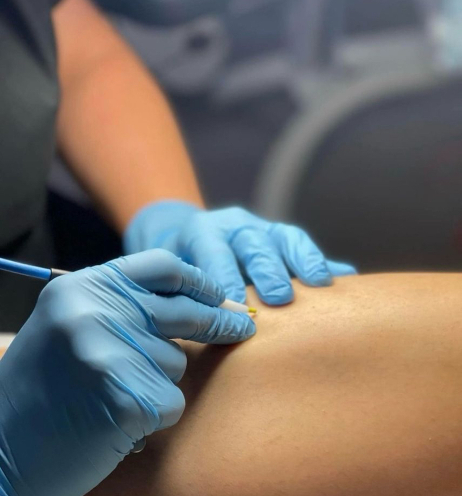 Electrolysis Bikini 60 Mins