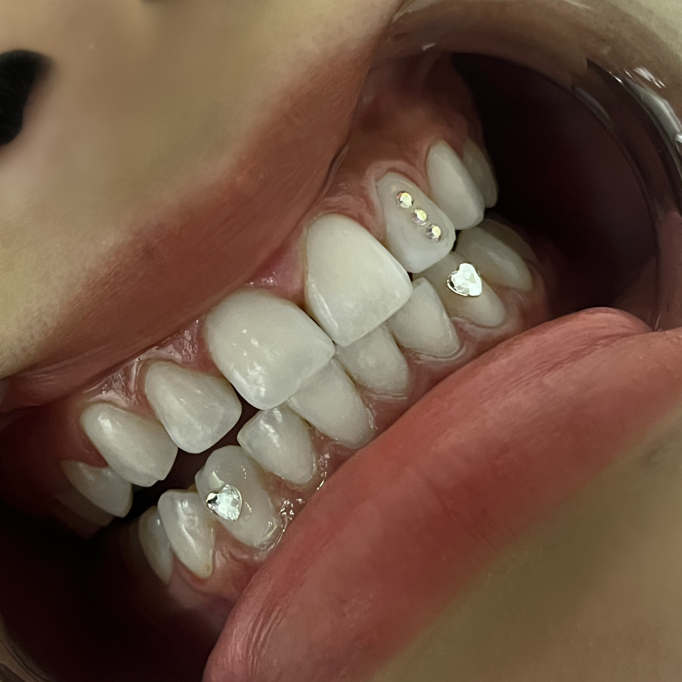Swarovski Tooth Gem at Balance Lashes Beauty Bar in Lake Wales, FL