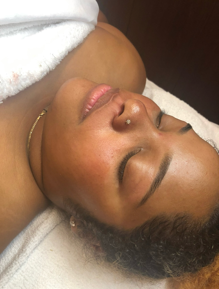 Dermaplanning Facial