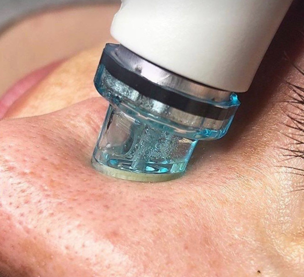Hydrating Facial at Moon Massages By Beauty Glam Spa in Ansonia, CT